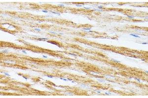 Immunohistochemistry of paraffin-embedded Rat heart using TPM2 Polyclonal Antibody at dilution of 1:100 (40x lens). (TPM2 anticorps)