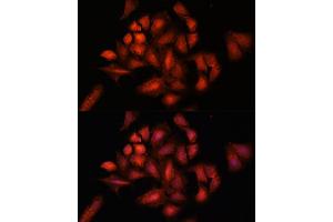 Immunofluorescence analysis of U-2 OS cells using ST antibody (ABIN6129464, ABIN6148550, ABIN6148551 and ABIN6222848) at dilution of 1:100.