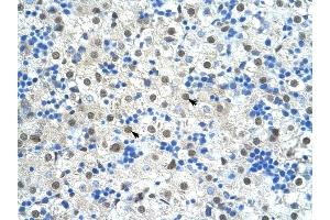 SF3B1 antibody was used for immunohistochemistry at a concentration of 4-8 ug/ml to stain Hepatocytes (arrows) in Human Liver. (SF3B1 anticorps  (N-Term))