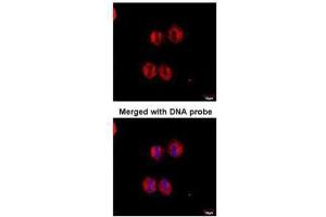 ICC/IF Image Immunofluorescence analysis of paraformaldehyde-fixed HeLaS3, using 14-3-3 zeta , antibody at 1:100 dilution.