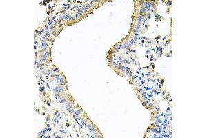 Immunohistochemistry of paraffin-embedded mouse lung using CHCHD3 antibody (ABIN5995784) at dilution of 1/100 (40x lens). (CHCHD3 anticorps)