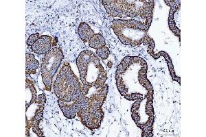IHC analysis of ALDH1B1 using anti-ALDH1B1 antibody (ABIN4886450).