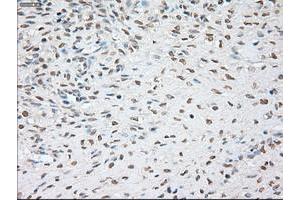 Immunohistochemistry (IHC) image for anti-Noggin (NOG) (AA 28-232) antibody (ABIN1491315)