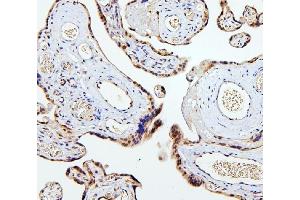 IHC analysis of SMAD2 using anti-SMAD2 antibody (ABIN6719361). (SMAD2 anticorps  (AA 83-264))