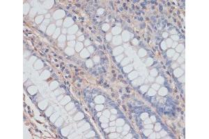 Immunohistochemistry of paraffin-embedded Human colon using ZNRF3 Polyclonal Antibody at dilution of 1:100 (40x lens). (ZNRF3 anticorps)