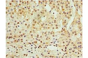 Immunohistochemistry of paraffin-embedded human adrenal gland tissue using ABIN7144558 at dilution of 1:100 (ADAP1 anticorps  (AA 1-374))