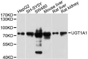 Western blot analysis of extracts of various cell lines, using UGT1A1 antibody. (UGT1A1 anticorps  (AA 1-200))