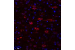 Immunofluorescence of paraffin embedded rat corpus striatum using TTC33 (ABIN7075871) at dilution of 1: 650 (300x lens) (TTC33 anticorps)