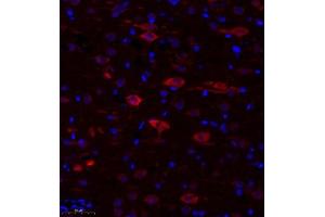 Immunofluorescence of paraffin embedded rat corpus striatum using TTC33 (ABIN7075871) at dilution of 1: 650 (300x lens) (TTC33 anticorps)