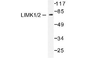 Image no. 1 for anti-LIM Domain Kinase 1 (LIMK1) antibody (ABIN265508) (LIM Domain Kinase 1 anticorps)