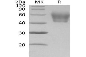 Western Blotting (WB) image for Interleukin 1 Receptor, Type II (IL1R2) protein (His tag) (ABIN7320551)