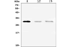 Western blot analysis of PTCRA using anti-PTCRA antibody (ABIN6719646).