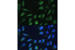 Immunofluorescence analysis of U-2 OS cells using DLST Polyclonal Antibody (ABIN6130277, ABIN6139665, ABIN6139667 and ABIN6217240) at dilution of 1:100 (40x lens).