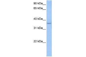 ACPT antibody used at 0. (ACPT anticorps  (Middle Region))