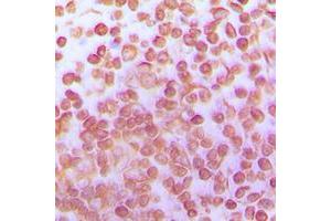 Immunohistochemical analysis of TFDP1 staining in human tonsil formalin fixed paraffin embedded tissue section. (DP1 anticorps  (C-Term))