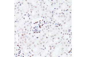 Immunohistochemistry of paraffin-embedded Mouse kidney using NSUN5 antibody ( ABIN7268955) at dilution of 1:100 (40x lens).