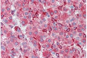 Human Adrenal (formalin-fixed, paraffin-embedded) stained with SERPINH1 antibody ABIN462363 followed by biotinylated anti-mouse IgG secondary antibody ABIN481714, alkaline phosphatase-streptavidin and chromogen. (SERPINH1 anticorps)