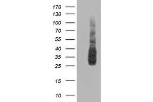 Western Blotting (WB) image for anti-ATG3 Autophagy Related 3 (ATG3) antibody (ABIN1496761) (ATG3 anticorps)