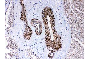 IHC analysis of CPI17 alpha using anti- CPI17 alpha antibody .