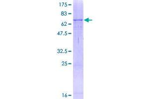 Image no. 1 for Tyrosinase (TYR) (AA 1-377) protein (GST tag) (ABIN1324261)