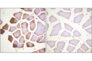 Immunohistochemistry analysis of paraffin-embedded human skeletal muscle tissue, using TNNI3 (Ab-22/23) Antibody. (TNNI3 anticorps  (AA 5-54))