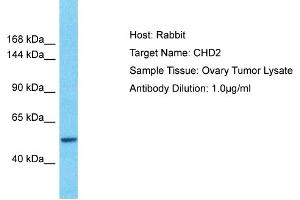 Host: Rabbit Target Name: CHD2 Sample Type: Ovary tumor lysates Antibody Dilution: 1. (CHD2 anticorps  (N-Term))