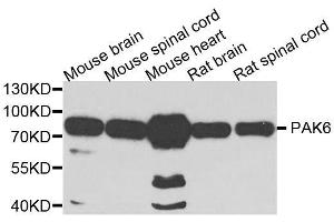 Western blot analysis of extracts of various cell lines, using PAK6 antibody.