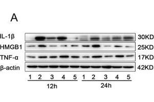 The effects of miR-339-5p and paeonol on LPS-induced RAW264.