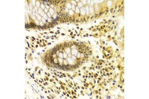 Immunohistochemistry of paraffin-embedded Human colon using MDM2 antibody at dilution of 1:100 (x400 lens).