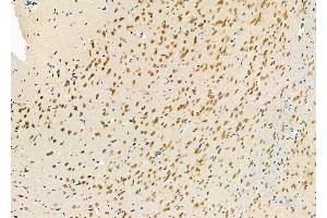 ABIN6264064 and ABIN6277250 at 1/100 staining Rat brain tissue by IHC-P. (PCBP2 anticorps  (Internal Region))