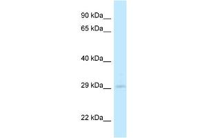 WB Suggested Anti-4933408B17Rik Antibody Titration: 1. (4933408B17Rik anticorps  (C-Term))