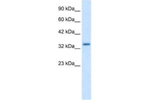Western Blotting (WB) image for anti-Zinc Finger Protein 134 (ZNF134) antibody (ABIN2461188) (ZNF134 anticorps)