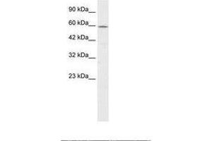 Image no. 1 for anti-Chaperonin Containing TCP1, Subunit 4 (Delta) (CCT4) (AA 453-502) antibody (ABIN6735873) (CCT4 anticorps  (AA 453-502))