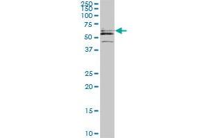 Western Blotting (WB) image for anti-Cytidine and DCMP Deaminase Domain Containing 1 (CDADC1) (AA 423-515) antibody (ABIN466247) (CDADC1 anticorps  (AA 423-515))