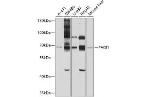 Western blot analysis of extracts of various cell lines, using P antibody (ABIN6128528, ABIN6145161, ABIN6145162 and ABIN6214293) at 1:1000 dilution. (PADI1 anticorps  (AA 1-260))