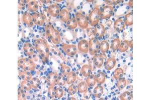 Used in DAB staining on fromalin fixed paraffin- embedded Kidney tissue (UBAP1 anticorps  (AA 1-224))
