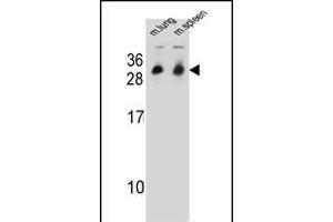 CYB561D1 Antibody (C-term) (ABIN654999 and ABIN2844633) western blot analysis in mouse lung,spleen tissue lysates (35 μg/lane). (CYB561D1 anticorps  (C-Term))
