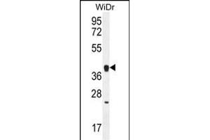 OR2T8 Antibody (C-term) (ABIN656071 and ABIN2845419) western blot analysis in WiDr cell line lysates (35 μg/lane). (OR2T8 anticorps  (C-Term))