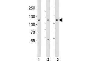 Western blot analysis of lysate from 1) HT-29, 2) HeLa, and 3) Jurkat cell line using JAK1 antibody; Ab was diluted at 1:1000. (JAK1 anticorps  (N-Term))