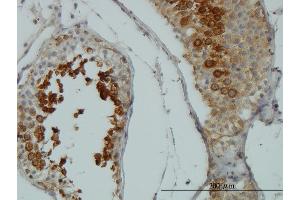 Immunoperoxidase of monoclonal antibody to AKT1 on formalin-fixed paraffin-embedded human testis. (AKT1 anticorps  (AA 1-480))