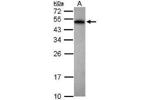 WB Image Sample (30 ug of whole cell lysate) A: Jurkat 12% SDS PAGE antibody diluted at 1:1000 (PABPN1 anticorps)
