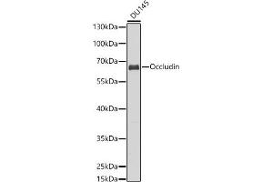 Western blot analysis of extracts of DU145 cells, using Occludin antibody (ABIN6129067, ABIN6144995, ABIN6144997 and ABIN6216324) at 1:1000 dilution.