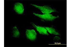 Immunofluorescence of purified MaxPab antibody to FGF1 on HeLa cell. (FGF1 anticorps  (AA 1-155))