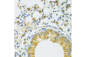 Immunohistochemistry of paraffin-embedded mouse lung using SLC37 antibody (ABIN7270453) at dilution of 1:100 (40x lens). (SLC37A4 anticorps  (C-Term))