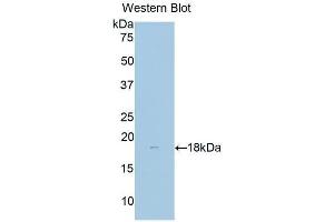 Detection of Recombinant dLK1, Human using Polyclonal Antibody to Delta Like 1 Homolog (dLK1) (DLK1 anticorps  (AA 177-326))