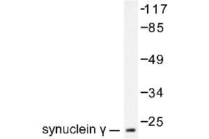 Image no. 1 for anti-Synuclein, gamma (Breast Cancer-Specific Protein 1) (SNCG) antibody (ABIN271916) (SNCG anticorps)