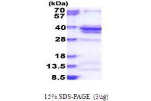SDS-PAGE (SDS) image for Ribosomal Protein L5 (RPL5) (AA 1-297) protein (His tag) (ABIN5853836) (RPL5 Protein (AA 1-297) (His tag))