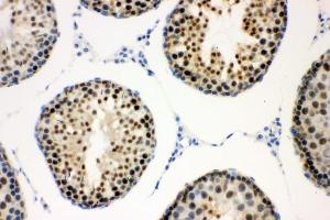 IHC analysis of CCNE1 using anti-CCNE1 antibody (ABIN7601193). (Cyclin E1 anticorps  (AA 3-386))