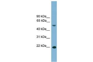 Human Spleen; WB Suggested Anti-HDGFRP3 Antibody Titration: 0. (HDGFRP3 anticorps  (Middle Region))