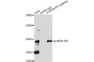 Immunoprecipitation analysis of 200ug extracts of HeLa cells treated by CA using 2.